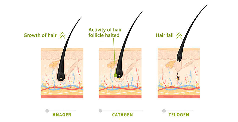 Deciphering Myth of Female Hair Loss - Trichoderm Black Series
